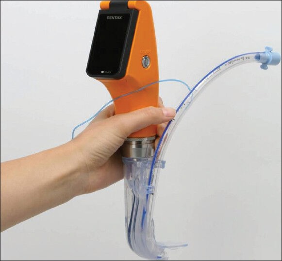 The Pentax AWS-VL-2 video laryngoscopy