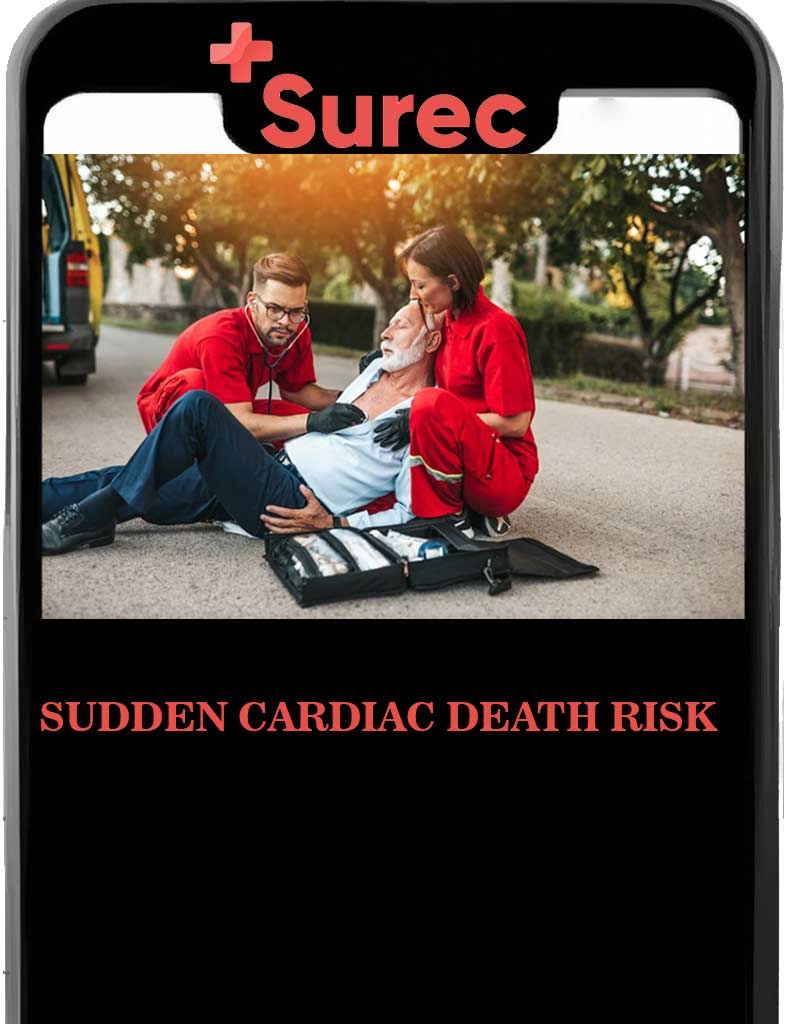 Sudden Cardiac Death Risk-Surec